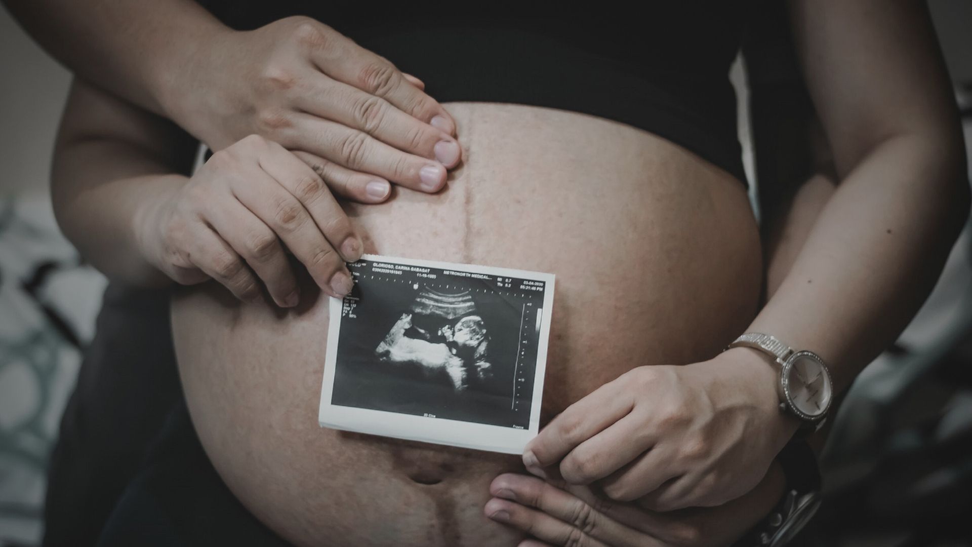 aborcja
